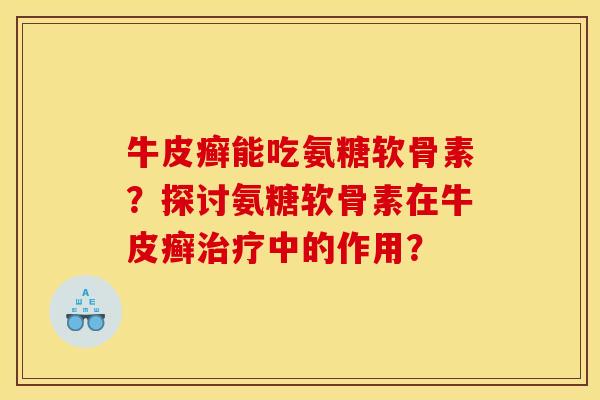 牛皮癣能吃氨糖软骨素？探讨氨糖软骨素在牛皮癣治疗中的作用？