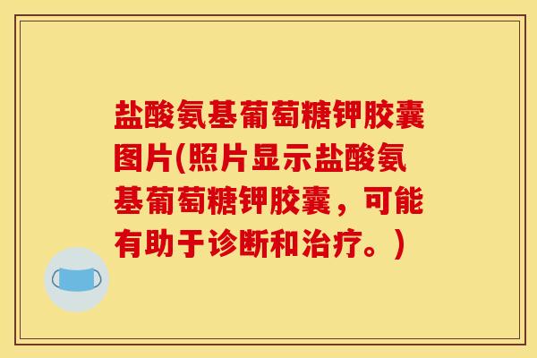 盐酸氨基葡萄糖钾胶囊图片(照片显示盐酸氨基葡萄糖钾胶囊，可能有助于诊断和治疗。)