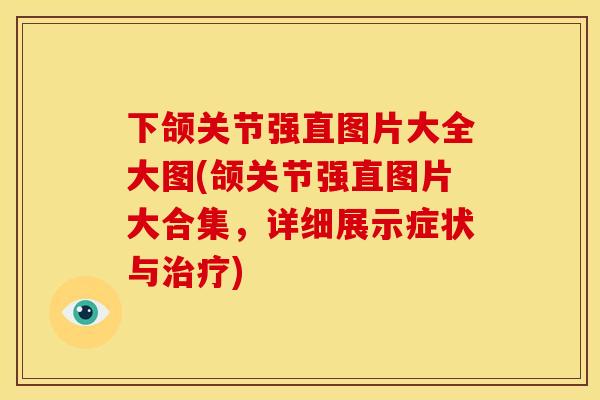 下颌关节强直图片大全大图(颌关节强直图片大合集，详细展示症状与治疗)