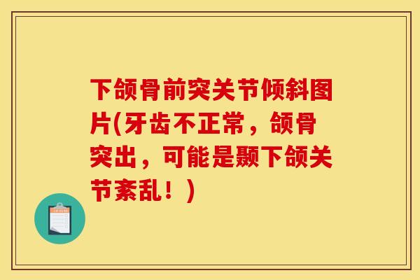 下颌骨前突关节倾斜图片(牙齿不正常，颌骨突出，可能是颞下颌关节紊乱！)