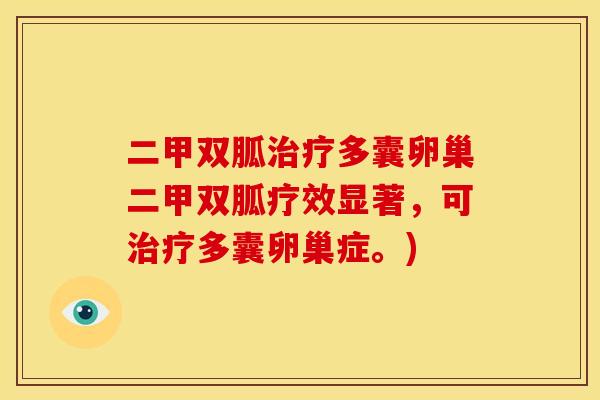 二甲双胍治疗多囊卵巢二甲双胍疗效显著，可治疗多囊卵巢症。)