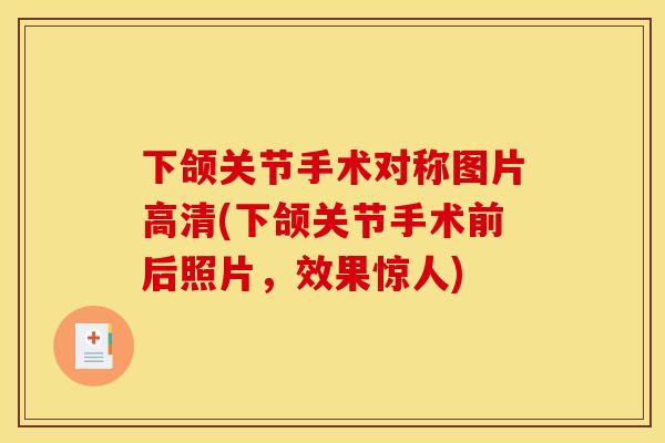 下颌关节手术对称图片高清(下颌关节手术前后照片，效果惊人)