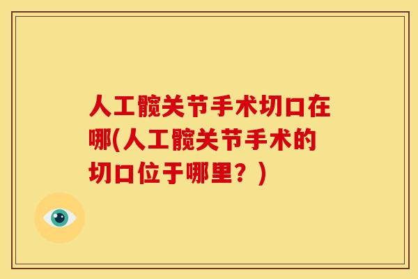 人工髋关节手术切口在哪(人工髋关节手术的切口位于哪里？)