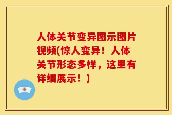 人体关节变异图示图片视频(惊人变异！人体关节形态多样，这里有详细展示！)
