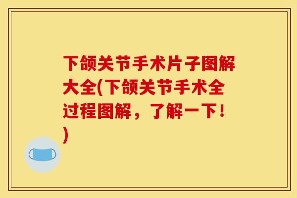 下颌关节手术片子图解大全(下颌关节手术全过程图解，了解一下！)