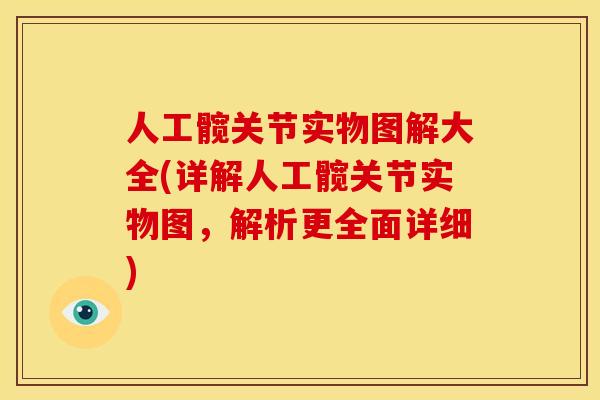 人工髋关节实物图解大全(详解人工髋关节实物图，解析更全面详细)