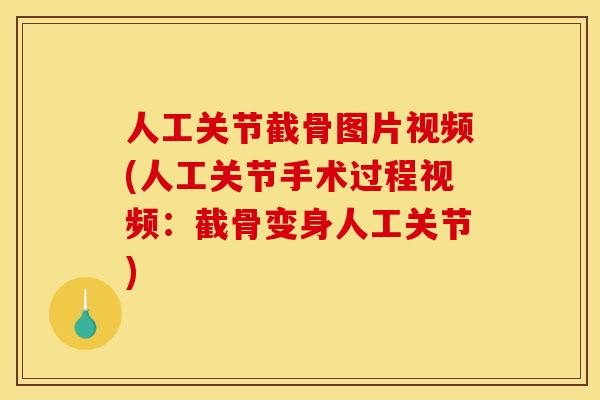 人工关节截骨图片视频(人工关节手术过程视频：截骨变身人工关节)