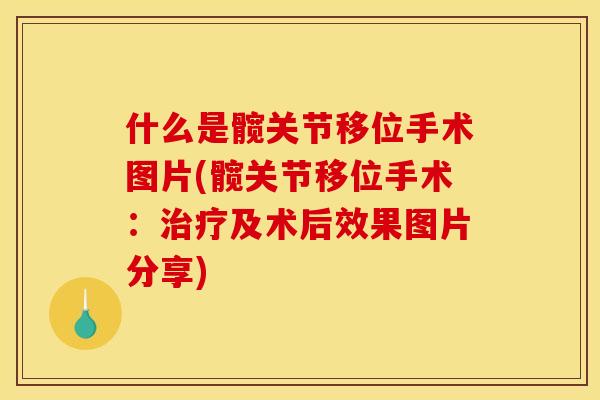什么是髋关节移位手术图片(髋关节移位手术：治疗及术后效果图片分享)