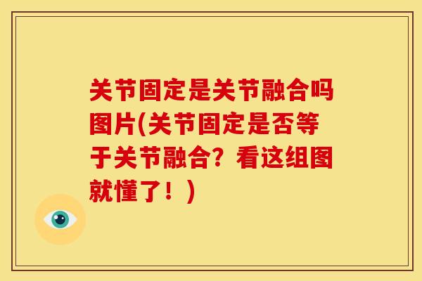 关节固定是关节融合吗图片(关节固定是否等于关节融合？看这组图就懂了！)