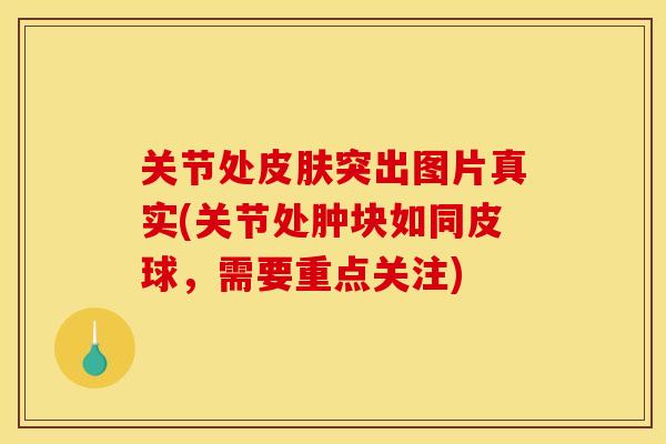 关节处皮肤突出图片真实(关节处肿块如同皮球，需要重点关注)