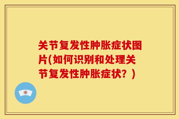 关节复发性肿胀症状图片(如何识别和处理关节复发性肿胀症状？)
