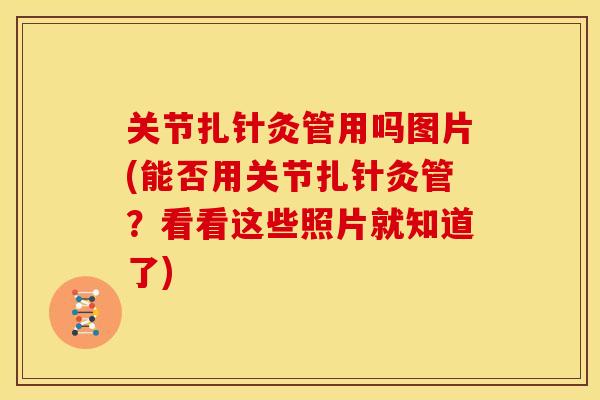 关节扎针灸管用吗图片(能否用关节扎针灸管？看看这些照片就知道了)