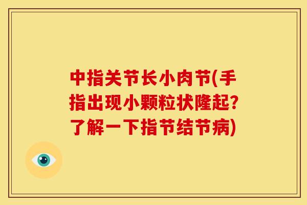 中指关节长小肉节(手指出现小颗粒状隆起？了解一下指节结节病)