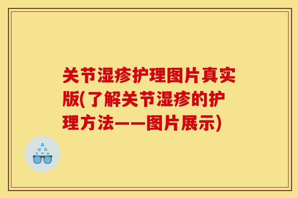 关节湿疹护理图片真实版(了解关节湿疹的护理方法——图片展示)