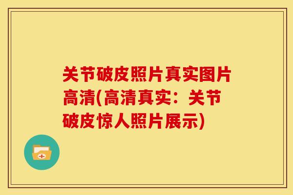 关节破皮照片真实图片高清(高清真实：关节破皮惊人照片展示)
