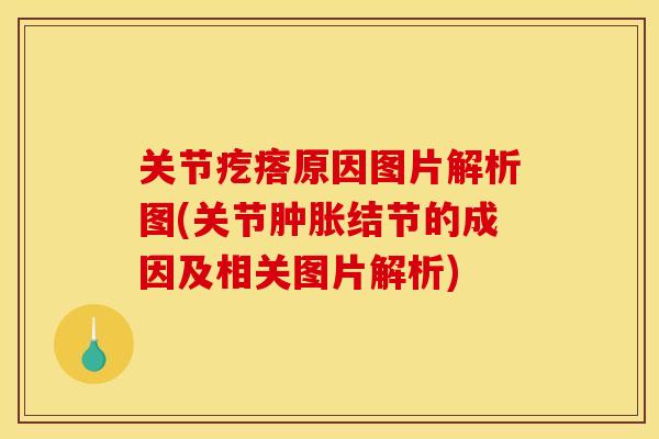 关节疙瘩原因图片解析图(关节肿胀结节的成因及相关图片解析)