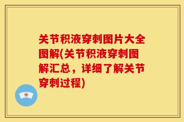 关节积液穿刺图片大全图解(关节积液穿刺图解汇总，详细了解关节穿刺过程)