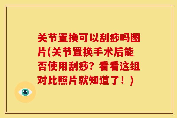 关节置换可以刮痧吗图片(关节置换手术后能否使用刮痧？看看这组对比照片就知道了！)