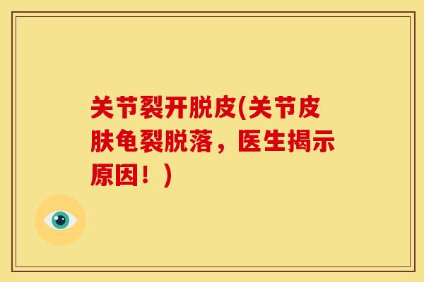 关节裂开脱皮(关节皮肤龟裂脱落，医生揭示原因！)