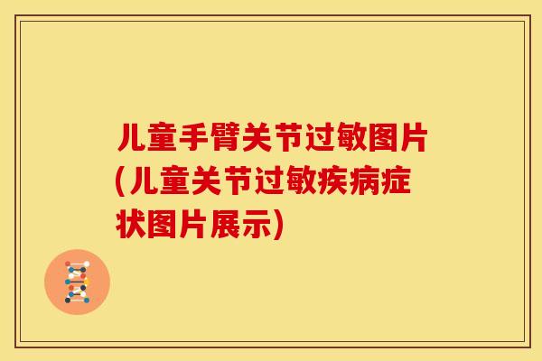 儿童手臂关节过敏图片(儿童关节过敏疾病症状图片展示)