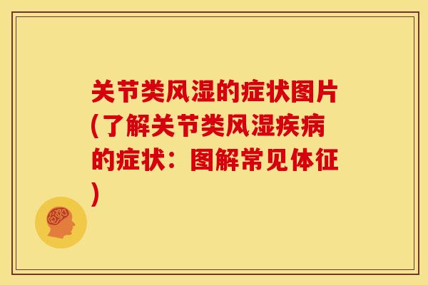 关节类风湿的症状图片(了解关节类风湿疾病的症状：图解常见体征)