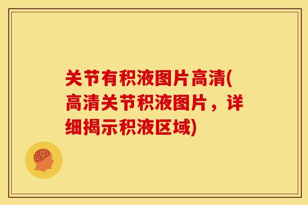关节有积液图片高清(高清关节积液图片，详细揭示积液区域)
