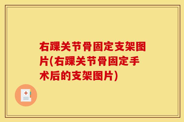 右踝关节骨固定支架图片(右踝关节骨固定手术后的支架图片)