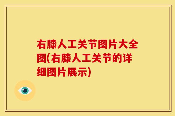 右膝人工关节图片大全图(右膝人工关节的详细图片展示)