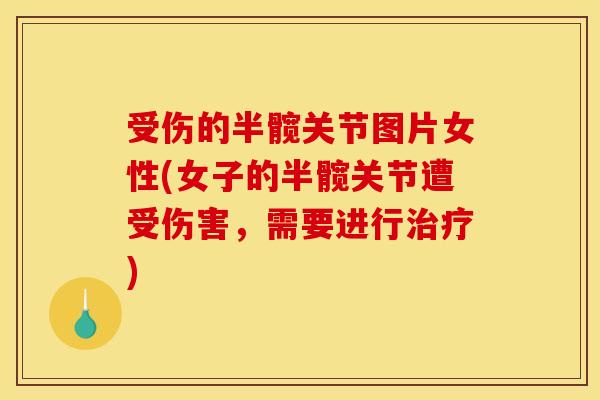 受伤的半髋关节图片女性(女子的半髋关节遭受伤害，需要进行治疗)