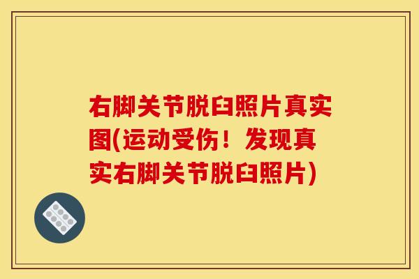右脚关节脱臼照片真实图(运动受伤！发现真实右脚关节脱臼照片)