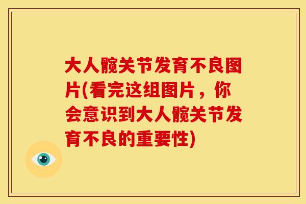 大人髋关节发育不良图片(看完这组图片，你会意识到大人髋关节发育不良的重要性)