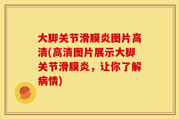 大脚关节滑膜炎图片高清(高清图片展示大脚关节滑膜炎，让你了解病情)