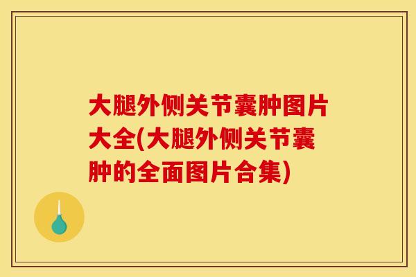大腿外侧关节囊肿图片大全(大腿外侧关节囊肿的全面图片合集)