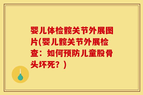 婴儿体检髋关节外展图片(婴儿髋关节外展检查：如何预防儿童股骨头坏死？)