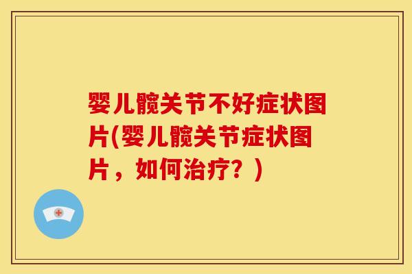 婴儿髋关节不好症状图片(婴儿髋关节症状图片，如何治疗？)