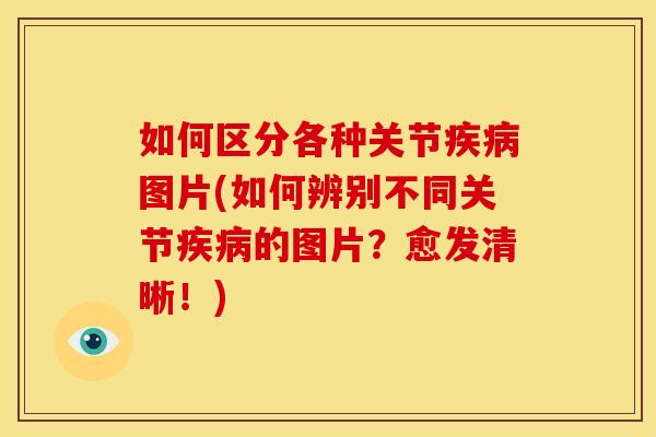 如何区分各种关节疾病图片(如何辨别不同关节疾病的图片？愈发清晰！)