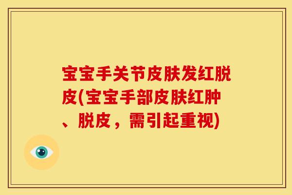 宝宝手关节皮肤发红脱皮(宝宝手部皮肤红肿、脱皮，需引起重视)