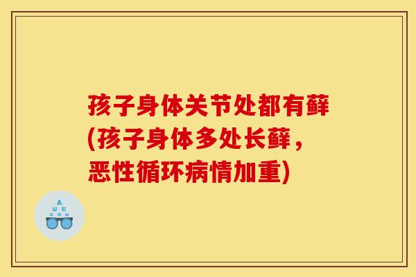 孩子身体关节处都有藓(孩子身体多处长藓，恶性循环病情加重)