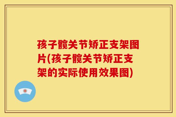 孩子髋关节矫正支架图片(孩子髋关节矫正支架的实际使用效果图)