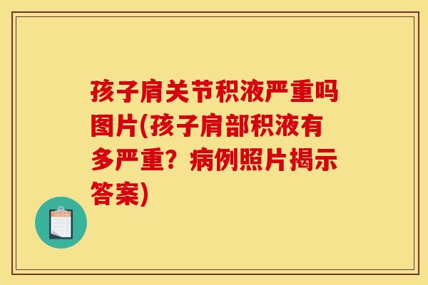 孩子肩关节积液严重吗图片(孩子肩部积液有多严重？病例照片揭示答案)