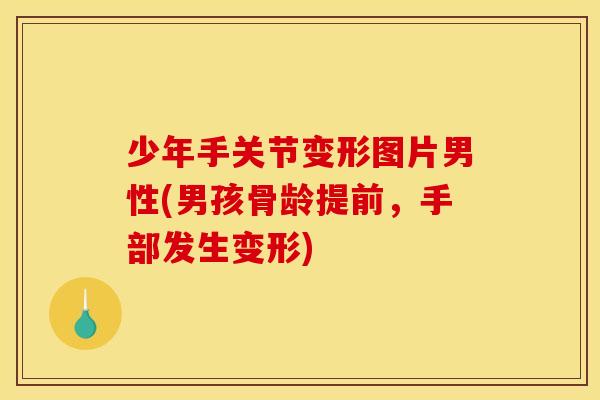 少年手关节变形图片男性(男孩骨龄提前，手部发生变形)