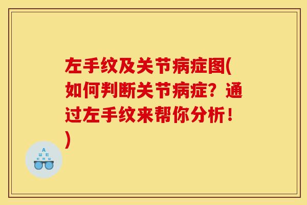 左手纹及关节病症图(如何判断关节病症？通过左手纹来帮你分析！)