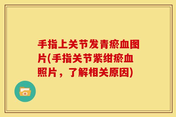 手指上关节发青瘀血图片(手指关节紫绀瘀血照片，了解相关原因)