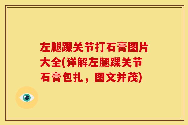 左腿踝关节打石膏图片大全(详解左腿踝关节石膏包扎，图文并茂)