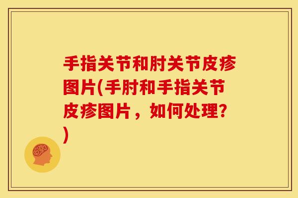 手指关节和肘关节皮疹图片(手肘和手指关节皮疹图片，如何处理？)