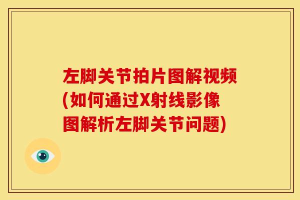 左脚关节拍片图解视频(如何通过X射线影像图解析左脚关节问题)