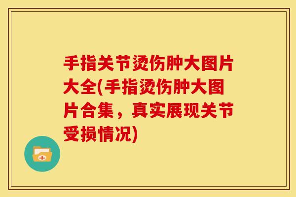 手指关节烫伤肿大图片大全(手指烫伤肿大图片合集，真实展现关节受损情况)