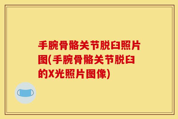 手腕骨骼关节脱臼照片图(手腕骨骼关节脱臼的X光照片图像)