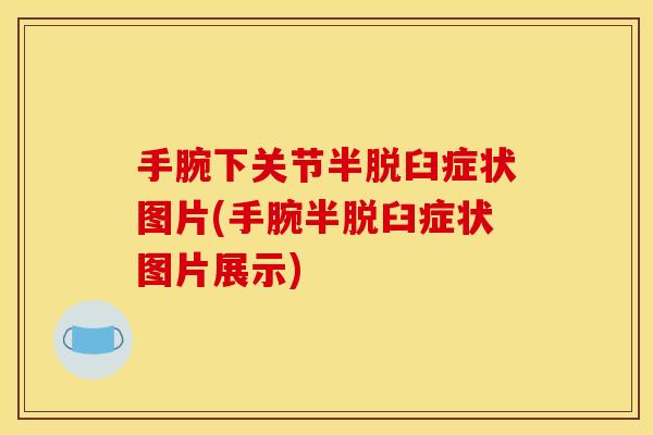 手腕下关节半脱臼症状图片(手腕半脱臼症状图片展示)