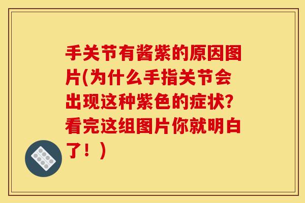 手关节有酱紫的原因图片(为什么手指关节会出现这种紫色的症状？看完这组图片你就明白了！)